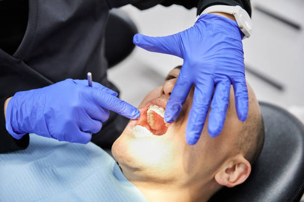 Best Emergency Dentist for Knocked-Out Tooth in Carter Lake, IA