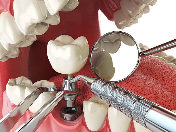Best Broken or Cracked Tooth Emergency Dentist in Carter Lake, IA